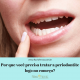 Como e quando tratar a periodontite?