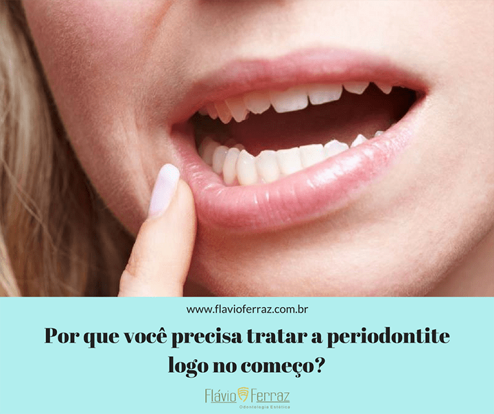 Como e quando tratar a periodontite?