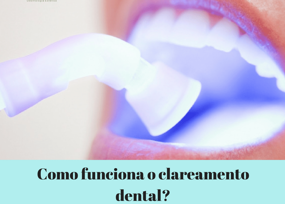clareamento_dental_Flavio_Ferraz