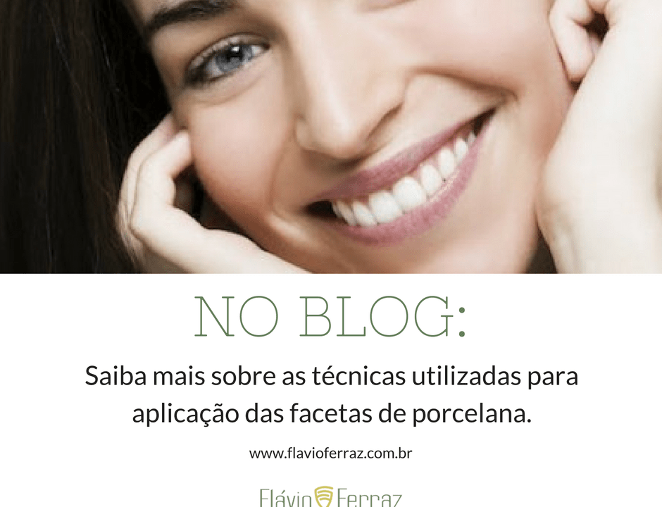 Flavio Ferraz Facetas de Porcelana