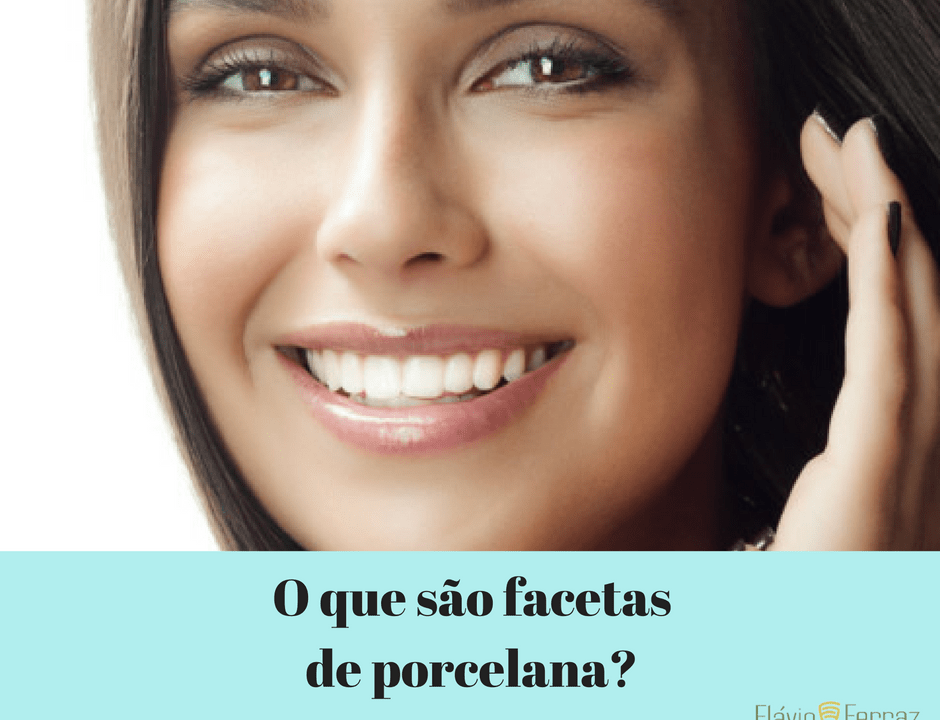 facetas-de-porcelana-flavio-ferraz-curitiba