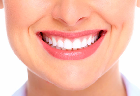4 dicas para manter o clareamento dental